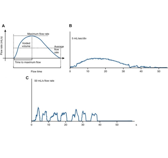 Uroflowmetry portfolio